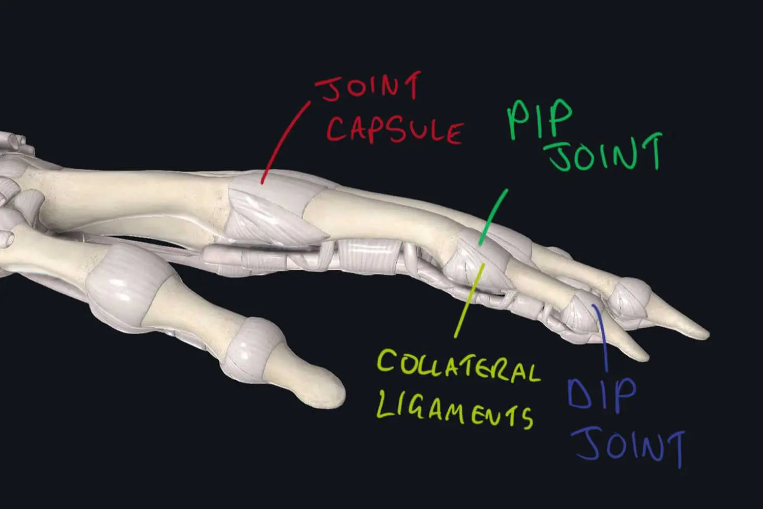 Climbing synovitis and joint swelling: How to beat it